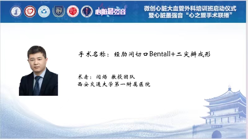 肋间小切口Bentall+二尖瓣成形术