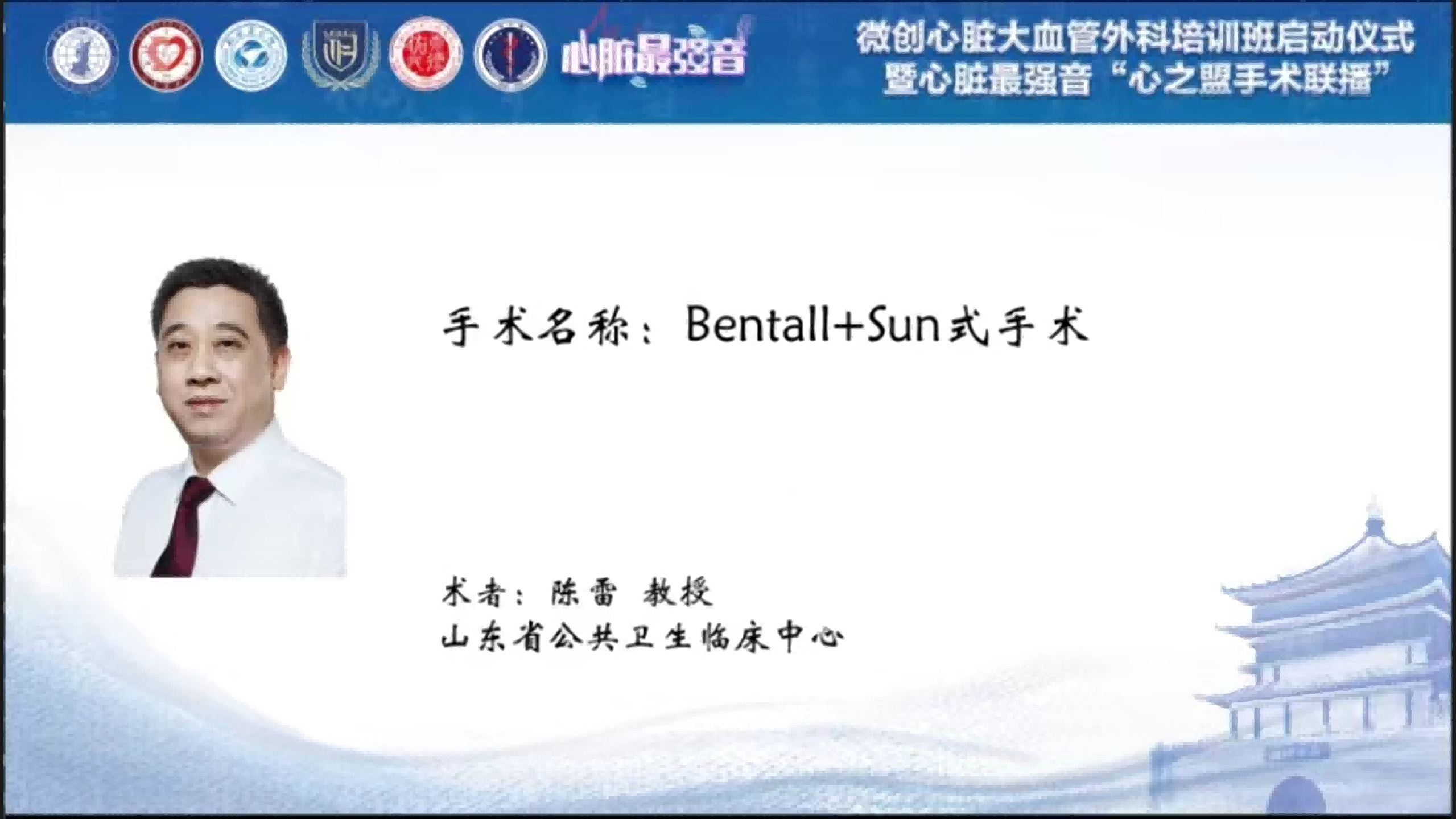 Bentall+Sun式手术