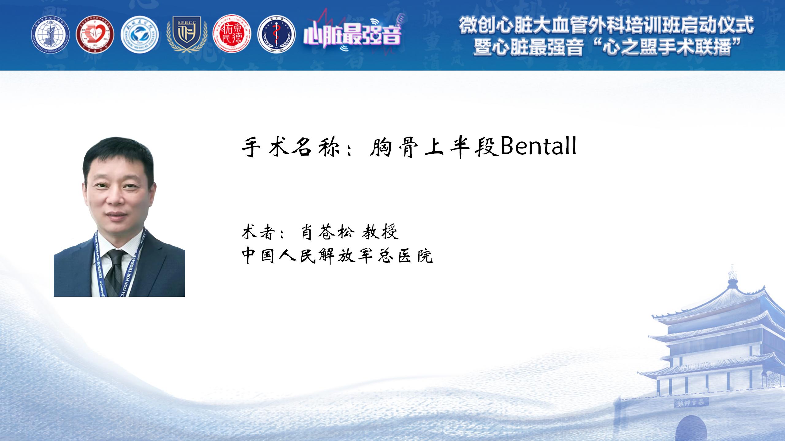 胸骨上半段Bentall