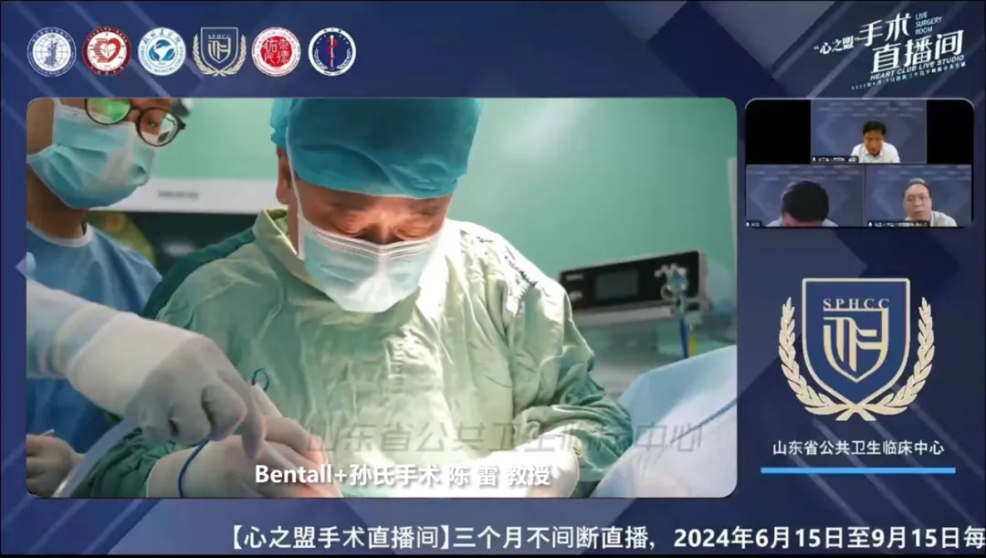 2024创全球纪录,展中国技术——“心之盟”三个月心脏手术直播完美收官(图5) 2024创全球纪录,展中国技术——“心之盟”三个月心脏手术直播完美收官(图5)