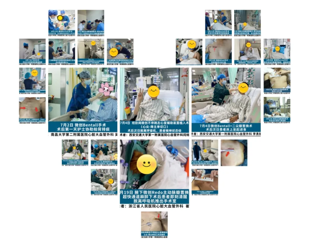 2024创全球纪录,展中国技术——“心之盟”三个月心脏手术直播完美收官(图7) 2024创全球纪录,展中国技术——“心之盟”三个月心脏手术直播完美收官(图7)