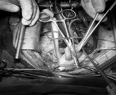 西安交通大学第一附属医院心血管外科特色医疗(图12)